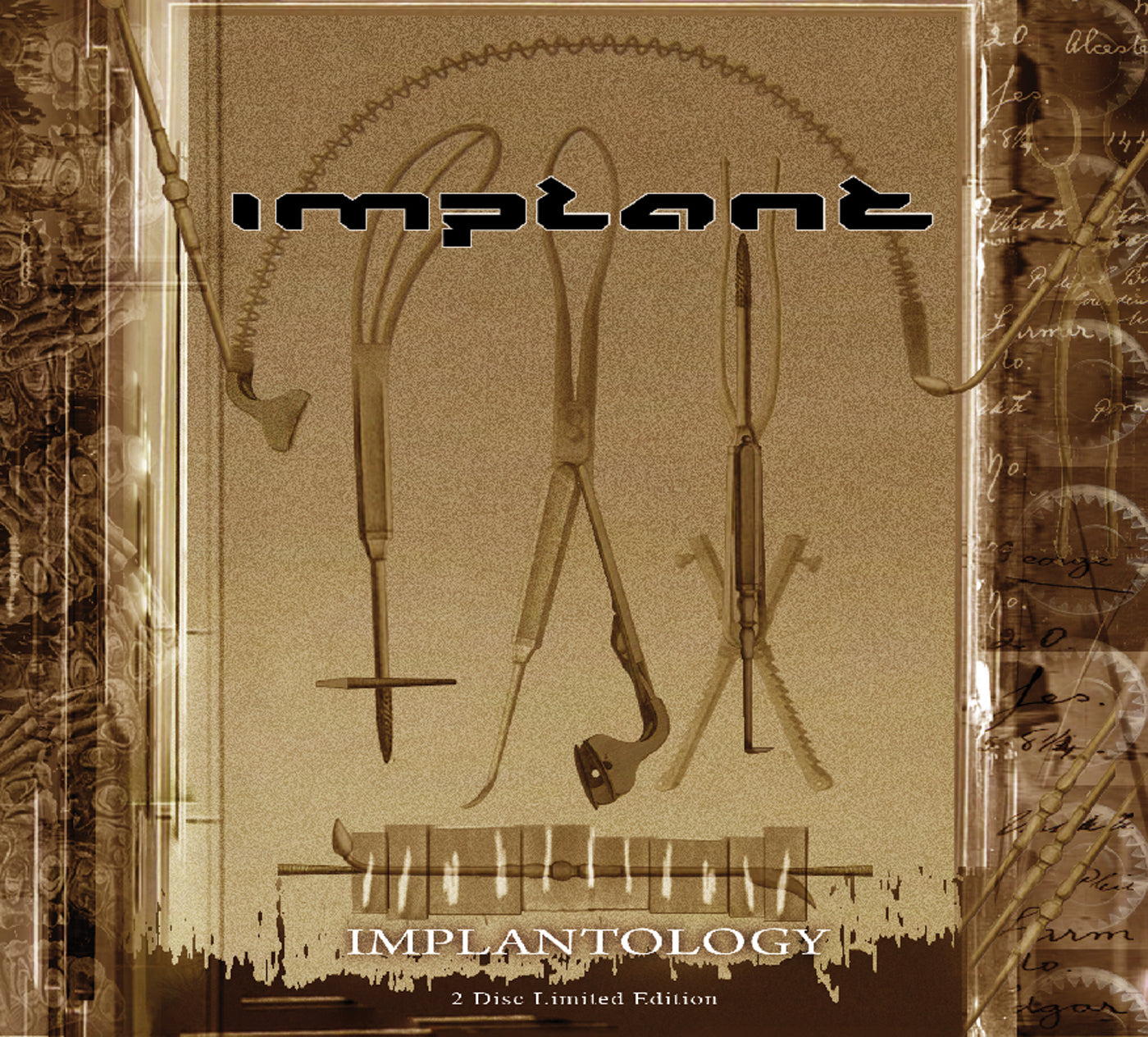 Implant - Implantology: Limited (CD)