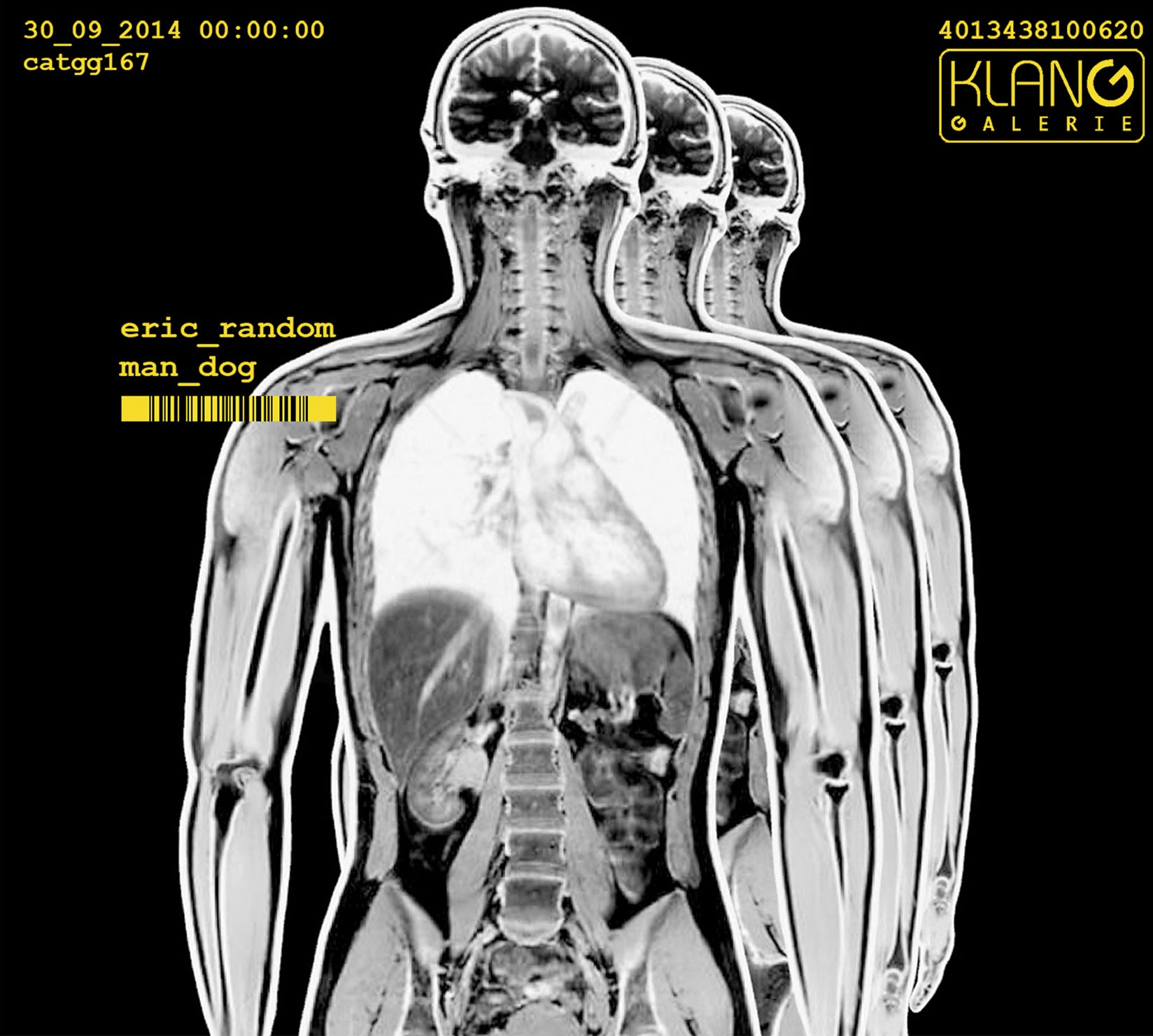 Eric Random - Man Dog (CD)