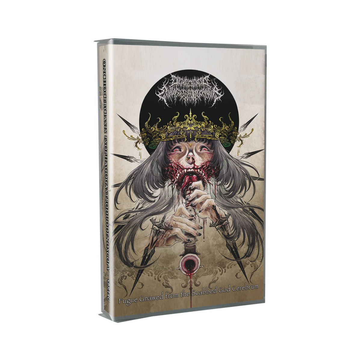 Onchocerciasis Esophagogastroduodenoscopy - Fugue Gnawed From The Scabbed God Cerebrum (CASSETTE)