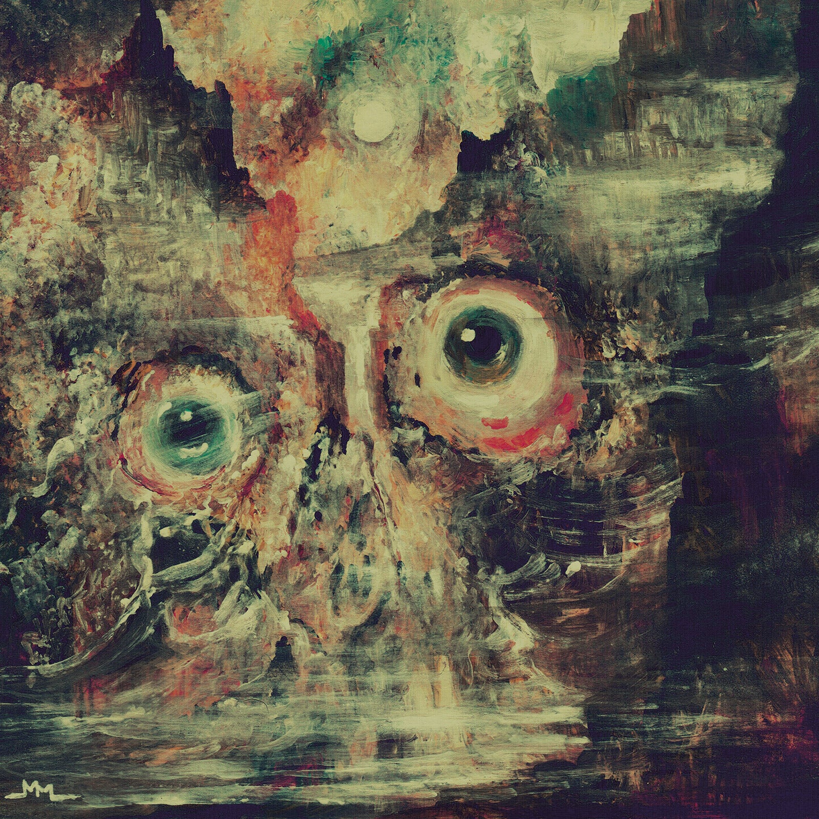 Teratoma - Purulent Manifestations (LP)