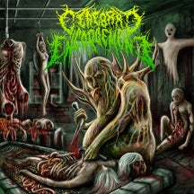 Cerebral Engorgement - Gastrointestinal Bleeding (CD)