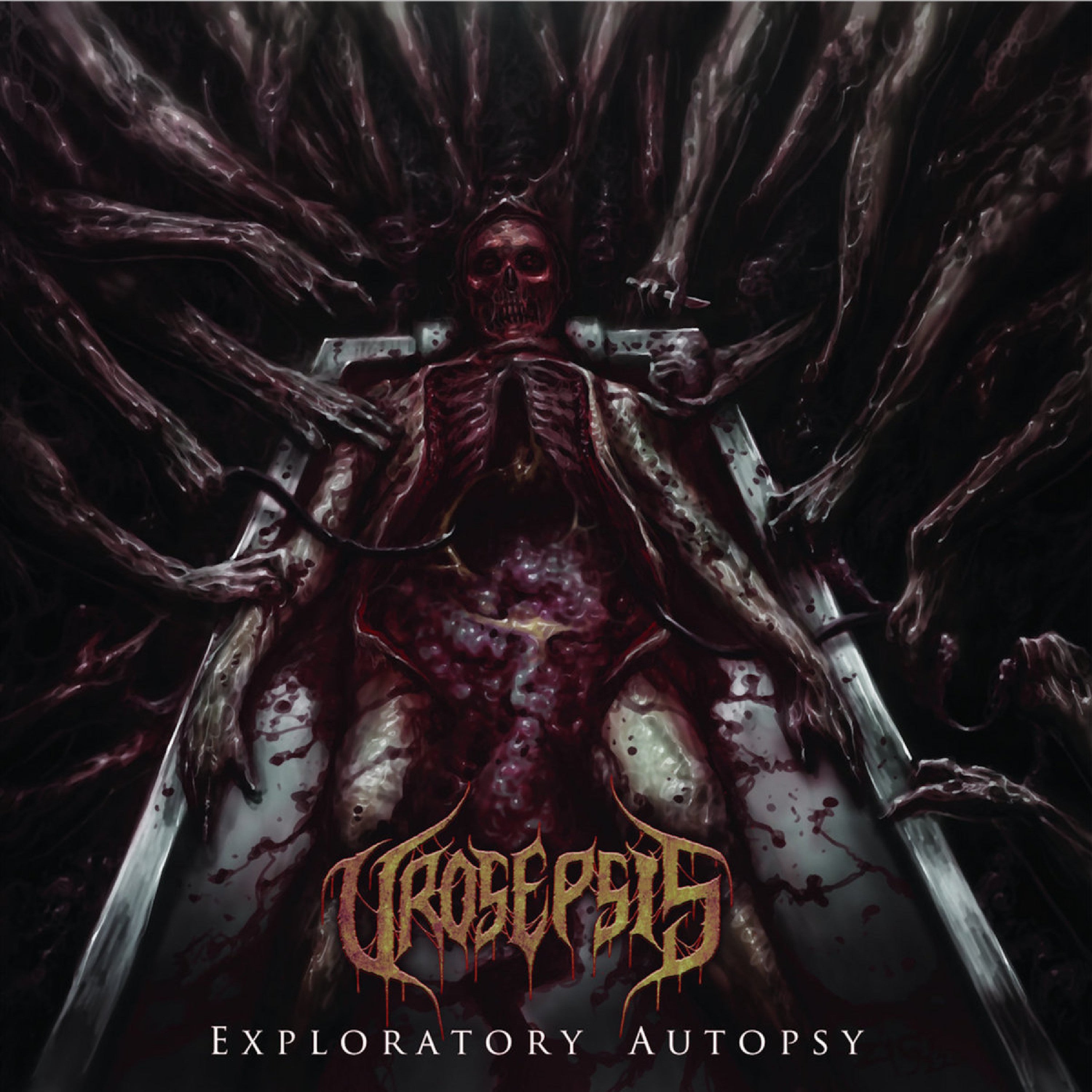 Urosepsis - Exploratory Autopsy (CD)