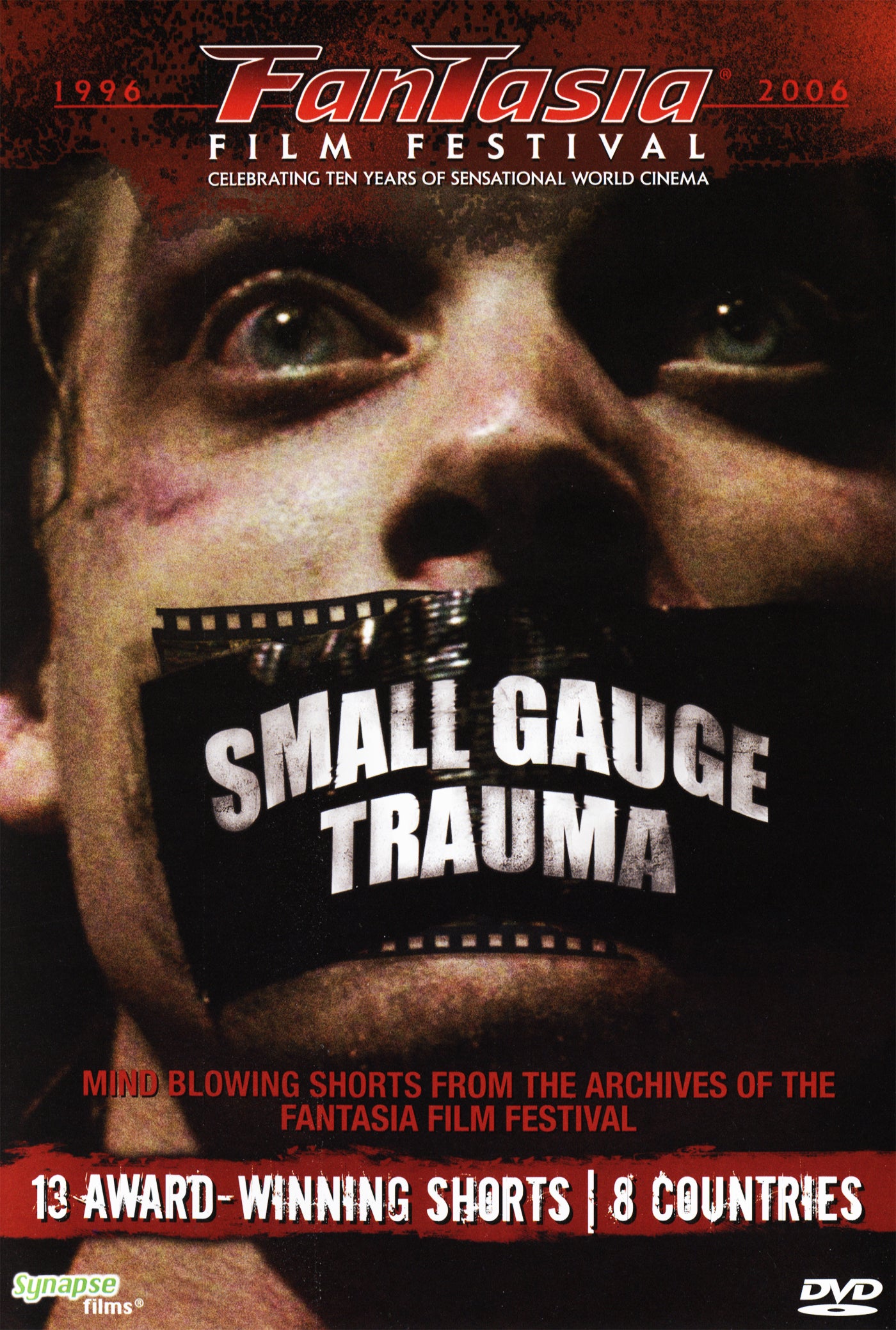 Small Gauge Trauma (DVD)