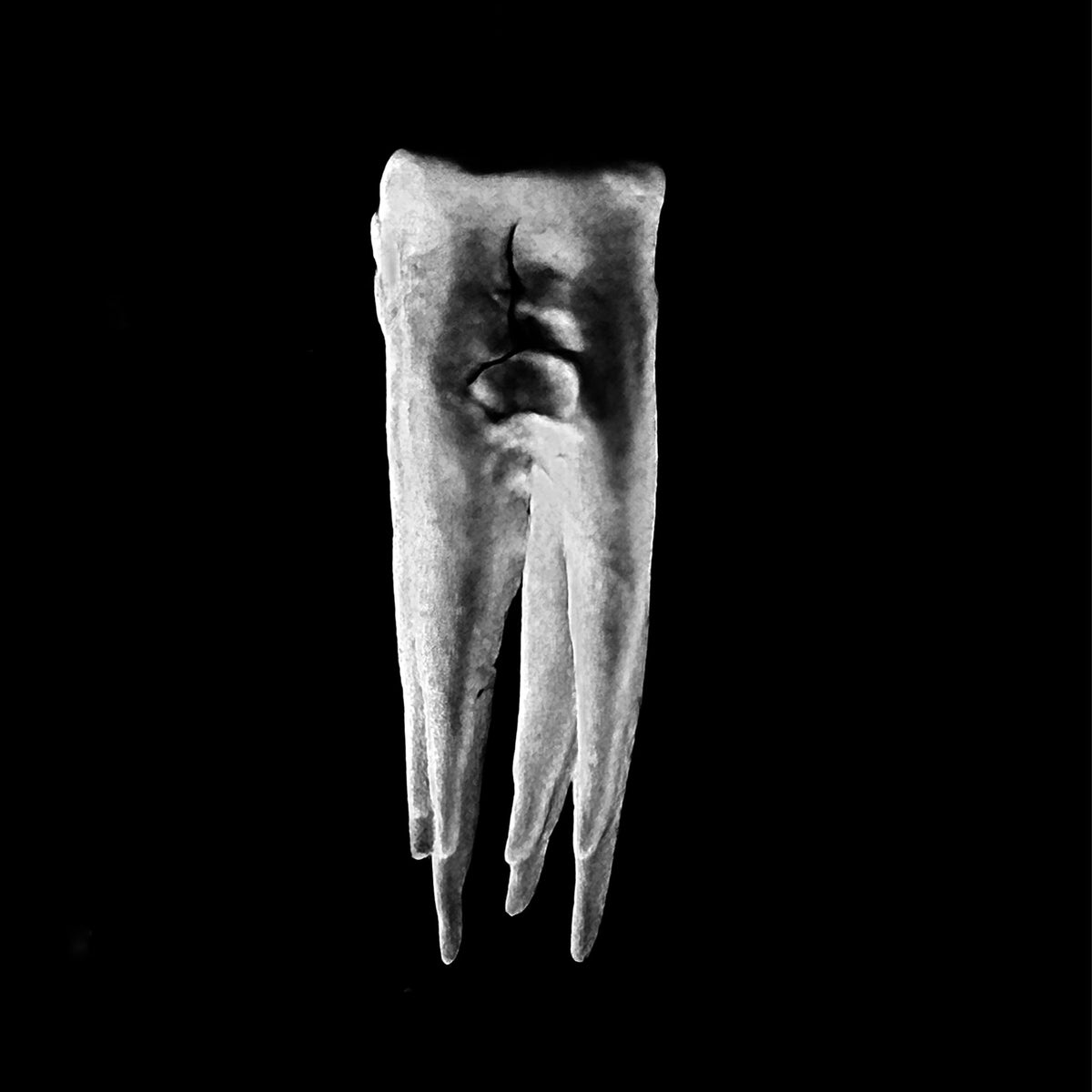 Chalk Teeth - Chalk Teeth (CASSETTE)
