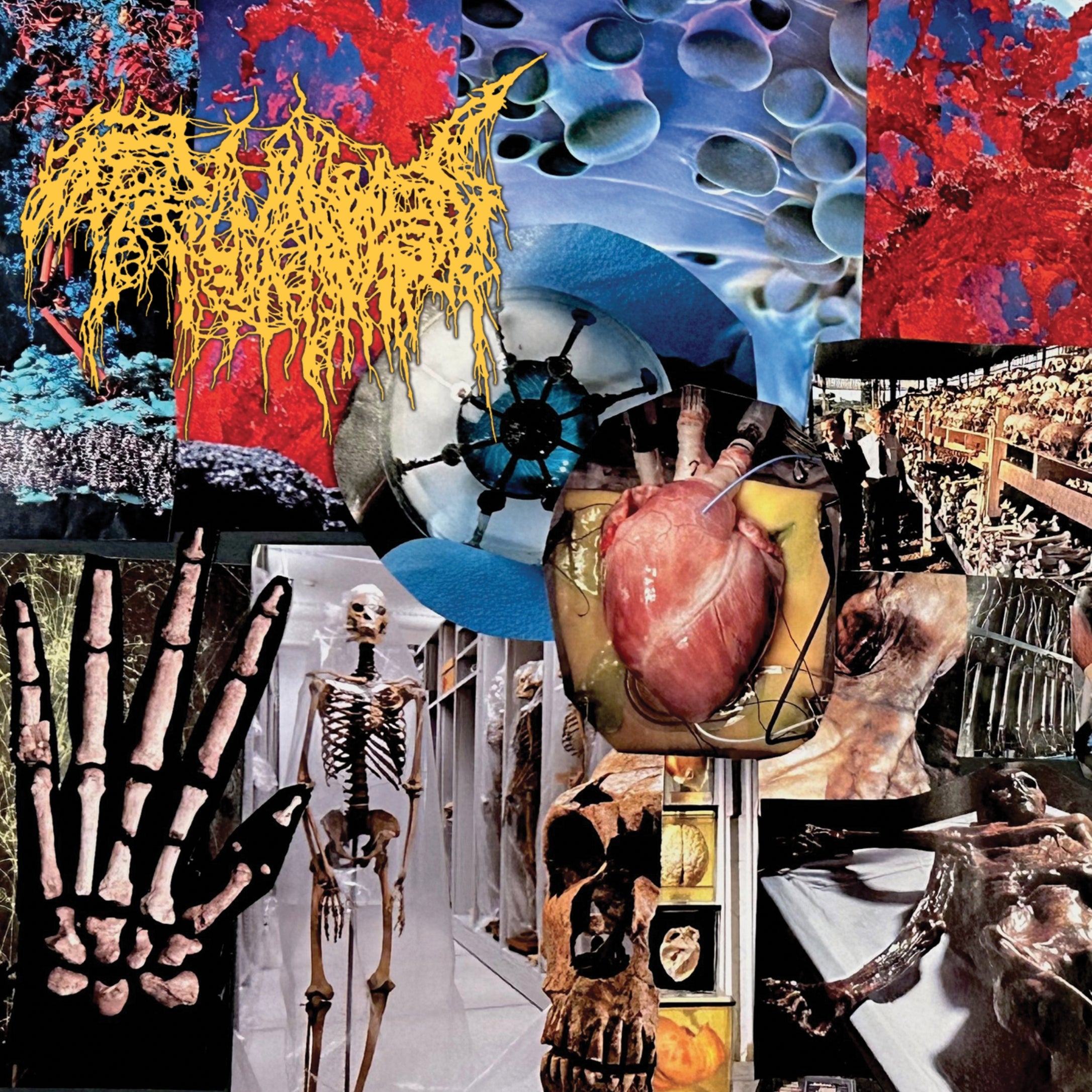 Trichomoniasis - Harvest Of The Killing Fields (CD)