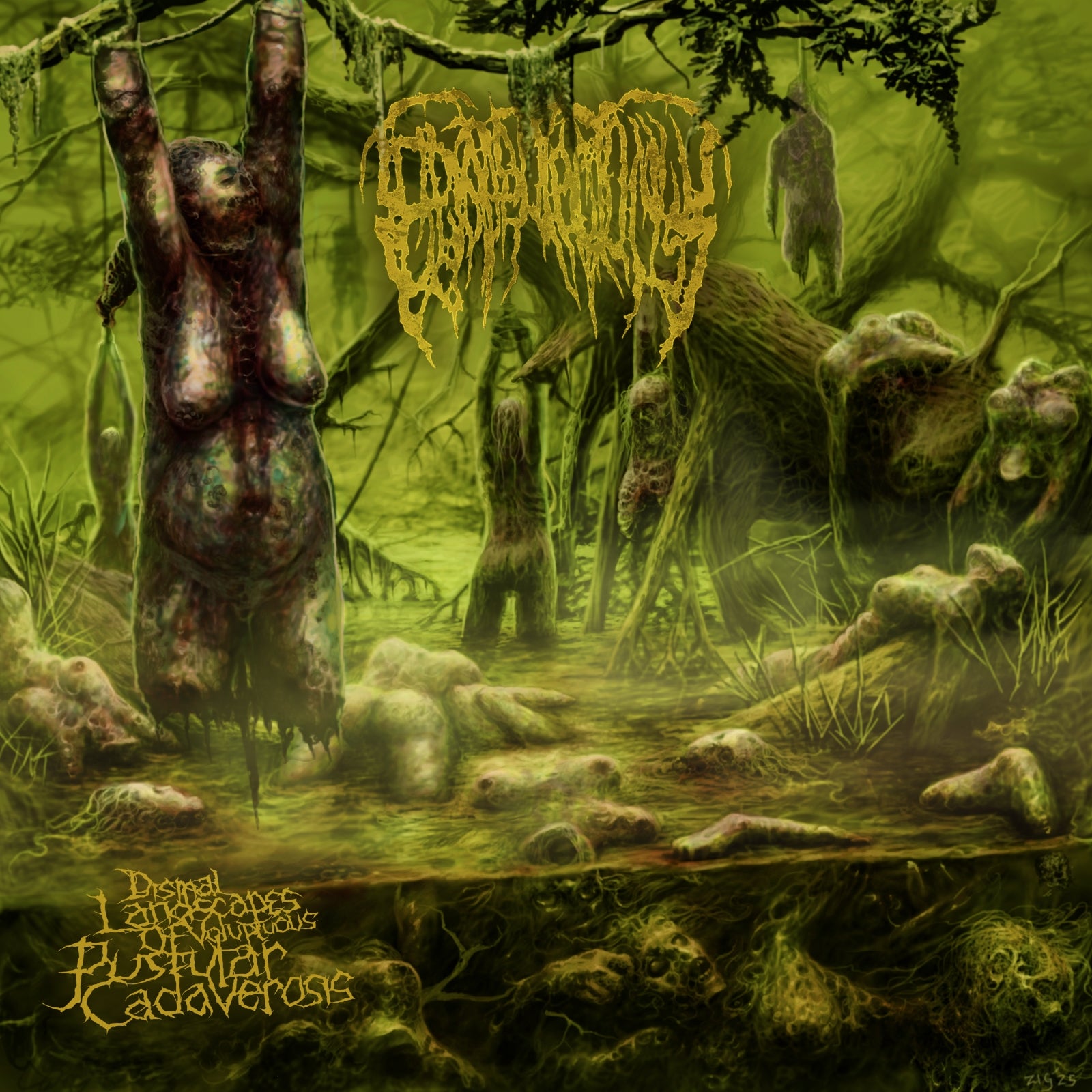 Epicardiectomy - Dismal Landscapes Of Voluptuous Pustular Cadaverosis (CD)